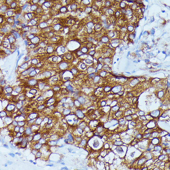 DDX6 Rabbit polyclonal antibody