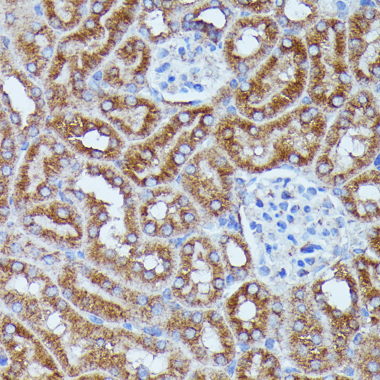 DDX6 Rabbit polyclonal antibody