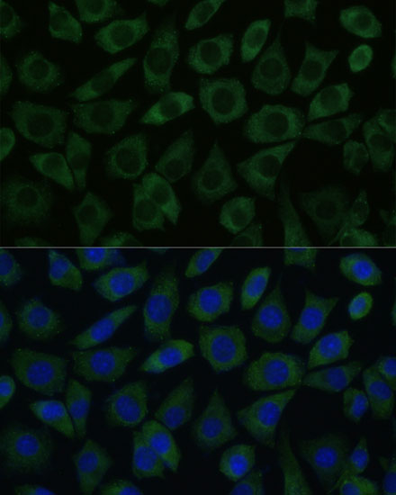 DDX6 Rabbit polyclonal antibody