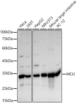 MCU Rabbit polyclonal antibody