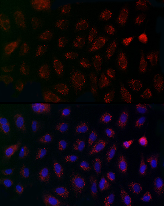 MCU Rabbit polyclonal antibody