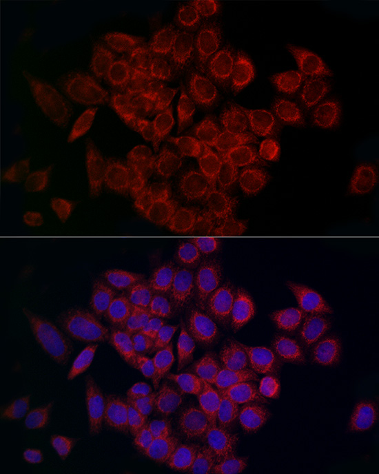 MCU Rabbit polyclonal antibody