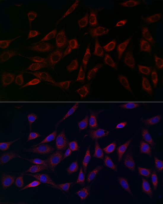 MCU Rabbit polyclonal antibody