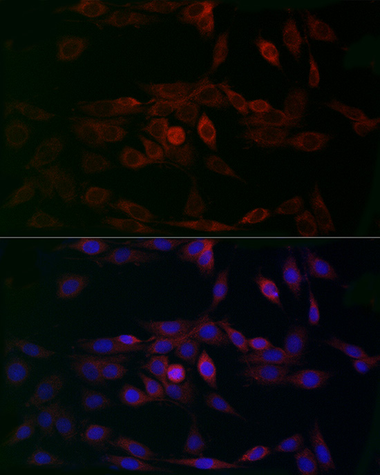 MCU Rabbit polyclonal antibody