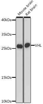 VHL Rabbit polyclonal antibody