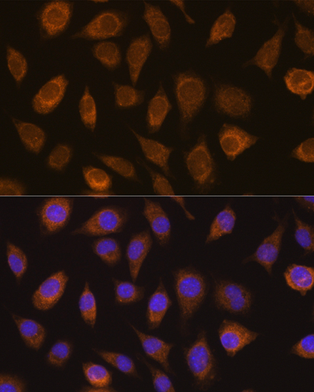 VHL Rabbit polyclonal antibody