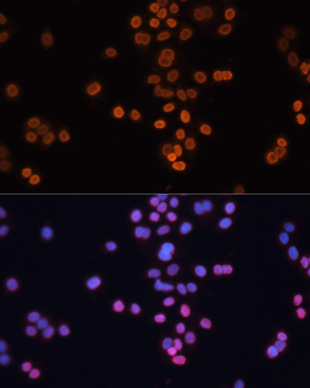 [KD Validated] CDX2 Rabbit polyclonal antibody