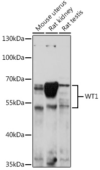 WT1 Rabbit polyclonal antibody