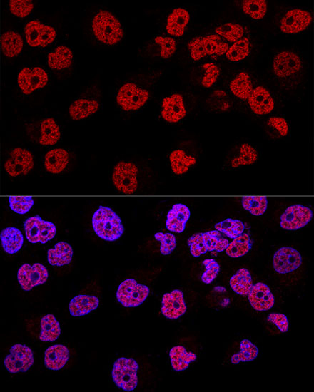 WT1 Rabbit polyclonal antibody