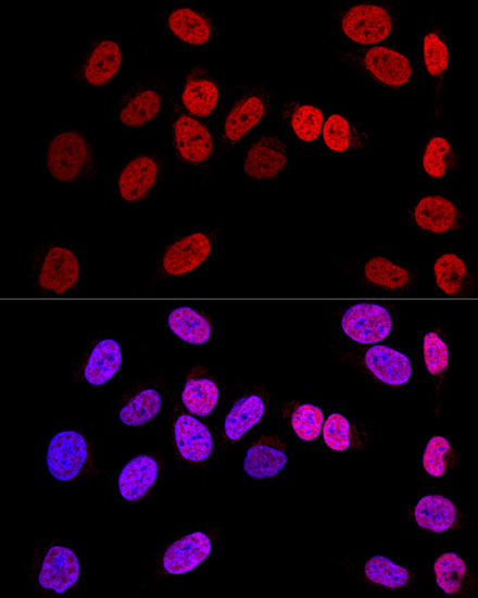 WT1 Rabbit polyclonal antibody
