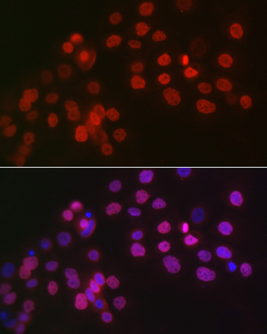WT1 Rabbit polyclonal antibody