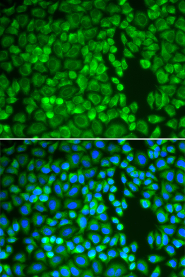 [KO Validated] Insulin-degrading enzyme (IDE) Rabbit polyclonal antibody