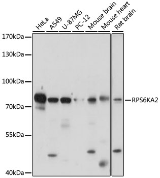 RPS6KA2 Rabbit polyclonal antibody
