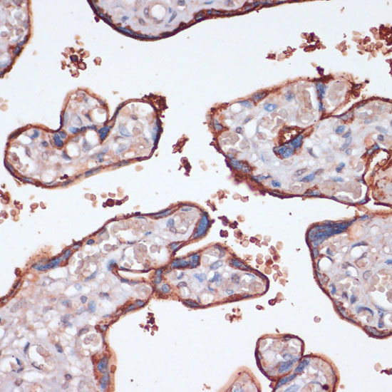 RPS6KA2 Rabbit polyclonal antibody
