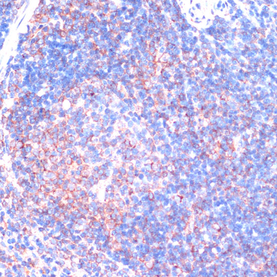 RPS6KA2 Rabbit polyclonal antibody