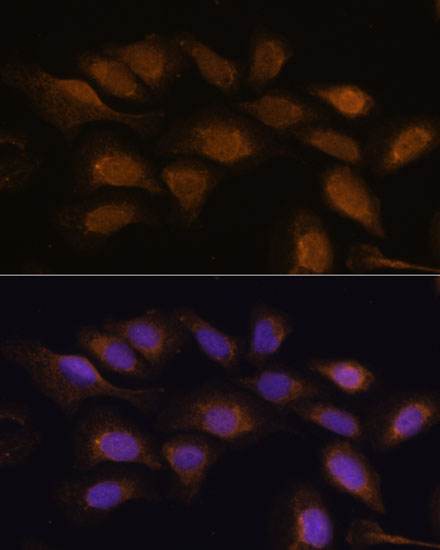 RPS6KA2 Rabbit polyclonal antibody