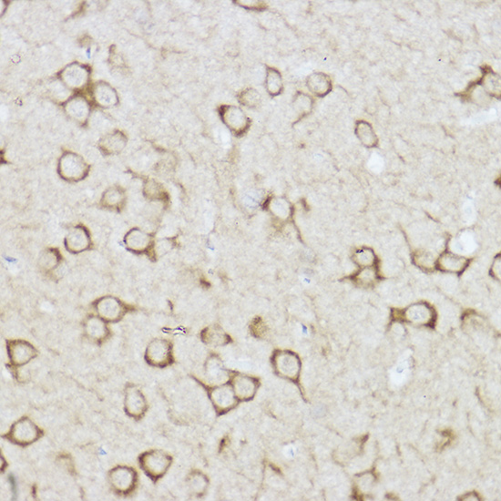 Raptor Rabbit polyclonal antibody