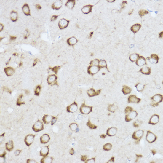 Raptor Rabbit polyclonal antibody