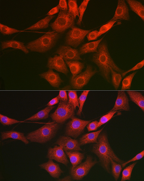 Raptor Rabbit polyclonal antibody
