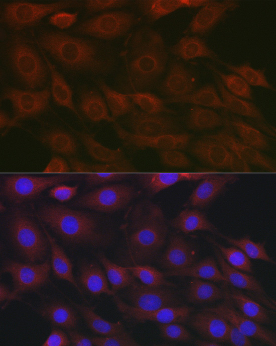 Raptor Rabbit polyclonal antibody