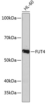FUT4 Rabbit polyclonal antibody