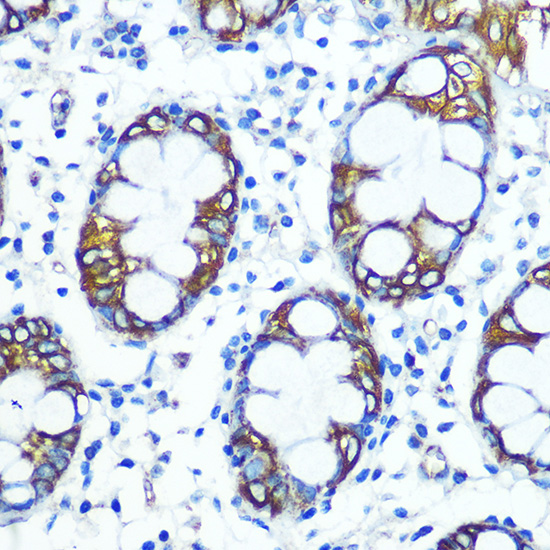 FUT4 Rabbit polyclonal antibody
