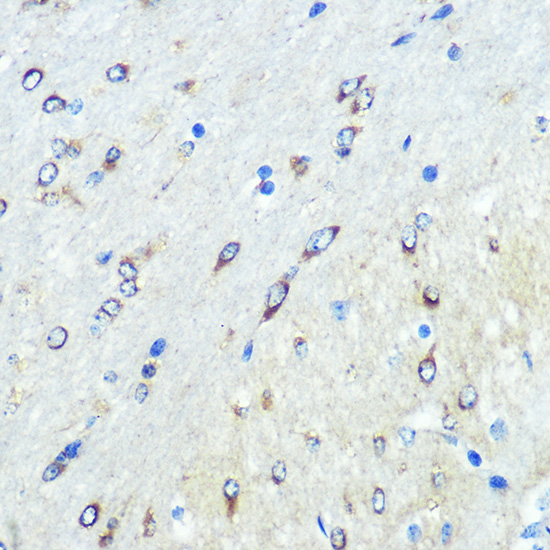 FUT4 Rabbit polyclonal antibody