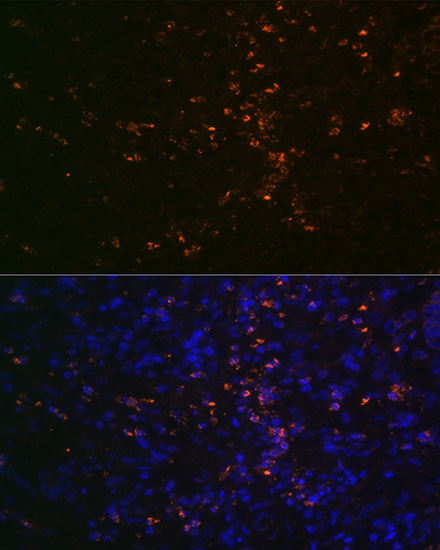 FUT4 Rabbit polyclonal antibody