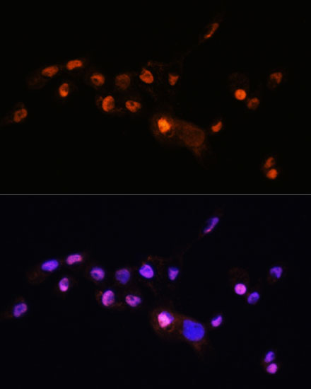 KLF8 Rabbit polyclonal antibody