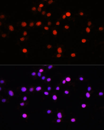 KLF8 Rabbit polyclonal antibody