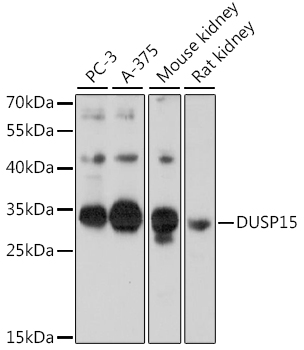 DUSP15 Rabbit polyclonal antibody