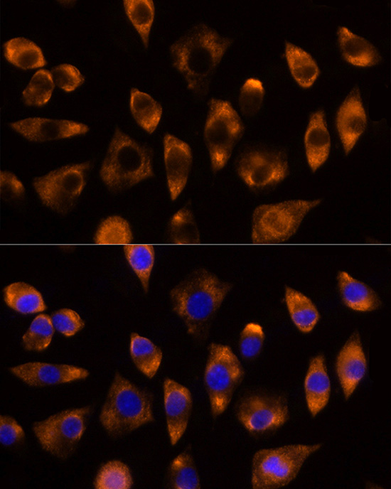 DUSP15 Rabbit polyclonal antibody