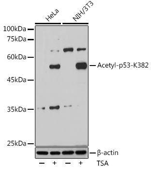 Acetyl-p53-K382 Rabbit mAb