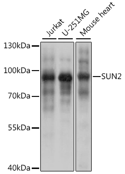 SUN2 Rabbit polyclonal antibody