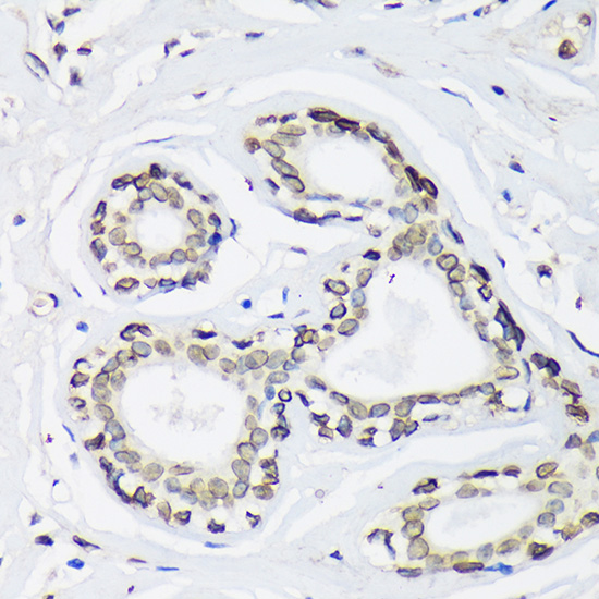 SUN2 Rabbit polyclonal antibody