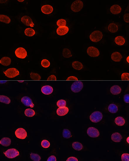 SUN2 Rabbit polyclonal antibody
