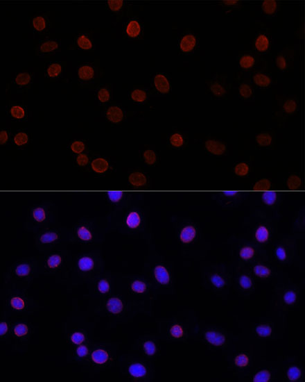 SUN2 Rabbit polyclonal antibody