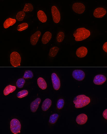 SUN2 Rabbit polyclonal antibody