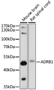 ADRB1 Rabbit polyclonal antibody