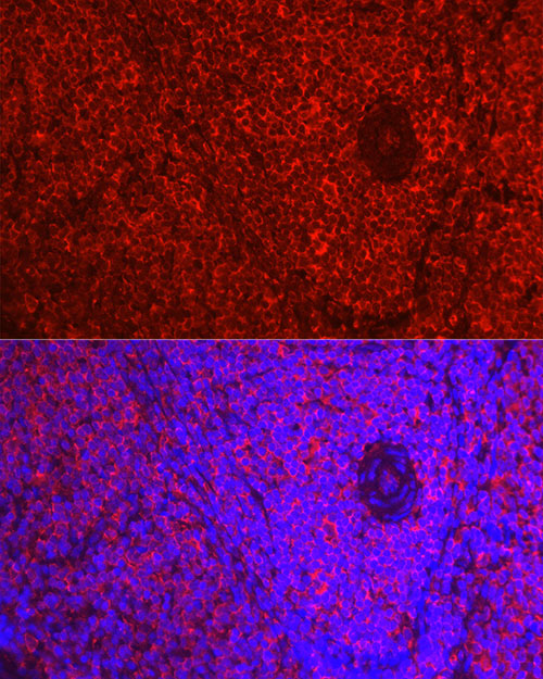 ADRB1 Rabbit polyclonal antibody