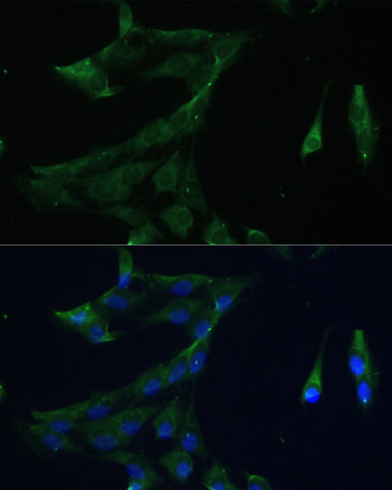 ARL3 Rabbit polyclonal antibody