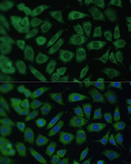 ARL3 Rabbit polyclonal antibody