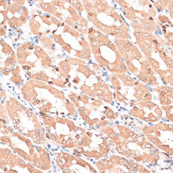 HMGA1 Rabbit polyclonal antibody