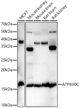 ATP6V0C Rabbit polyclonal antibody