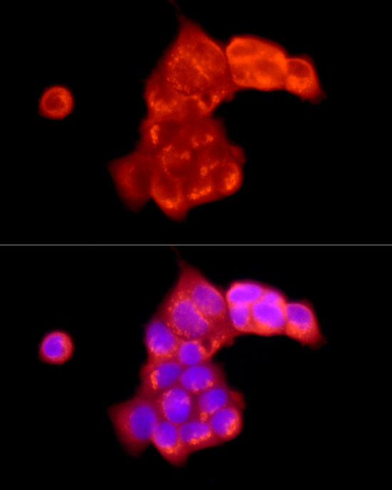 ATP6V0C Rabbit polyclonal antibody