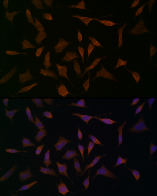 BCAT1 Rabbit polyclonal antibody