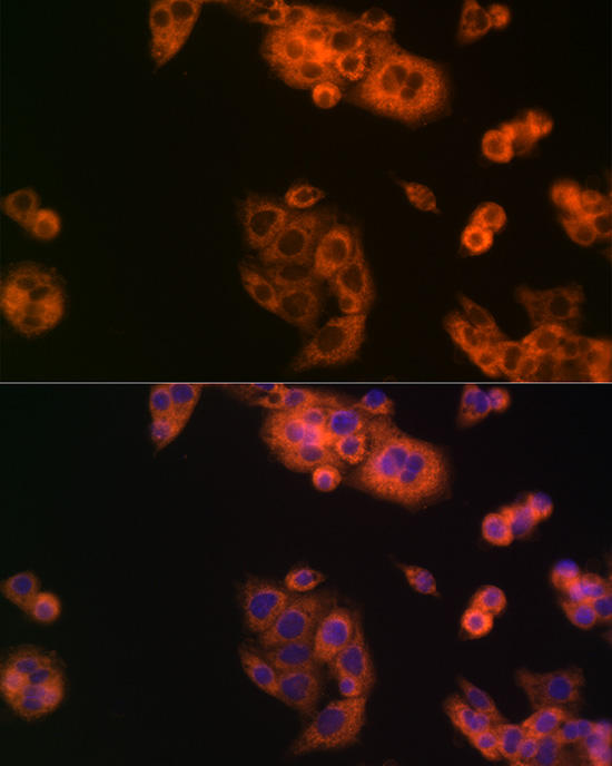 BCAT1 Rabbit polyclonal antibody