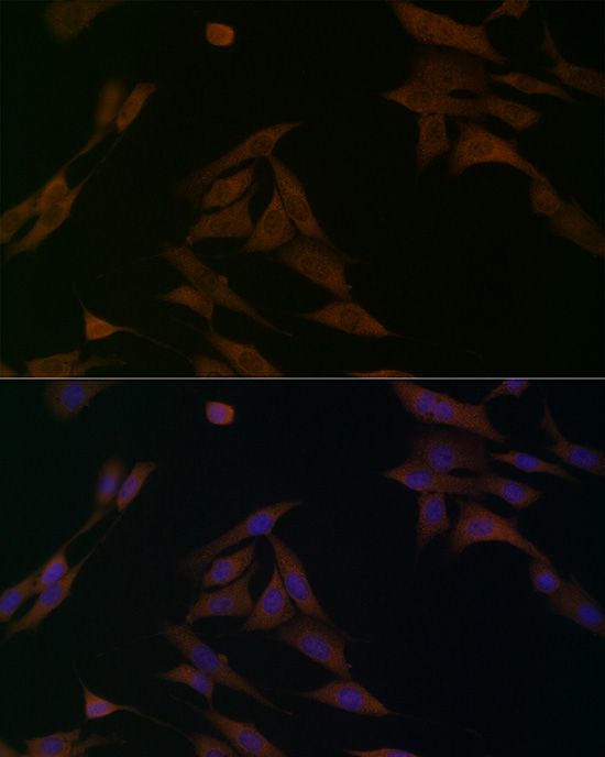 BCAT1 Rabbit polyclonal antibody