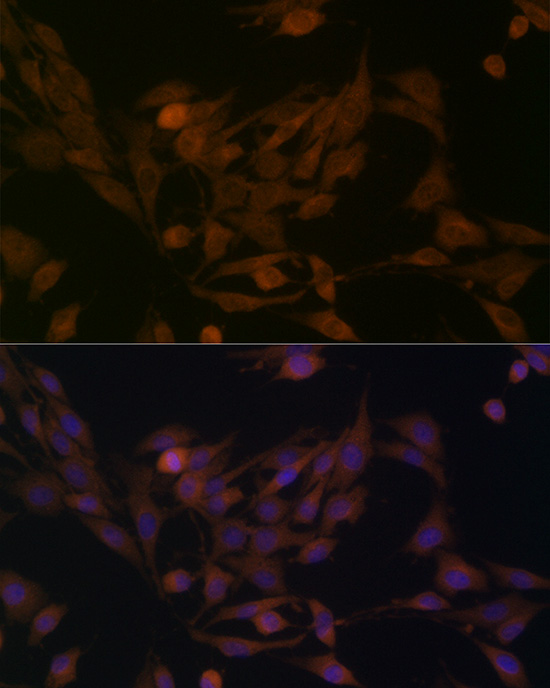 BCAT1 Rabbit polyclonal antibody