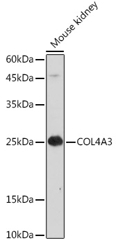COL4A3 Rabbit polyclonal antibody